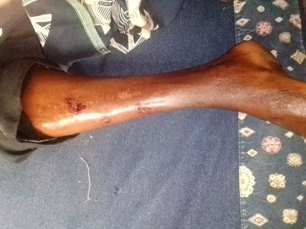 img_0276-2-1-1024x767 ABDUCTION AND TORTURED OF MR KARI FELIX BY CAMEROON OCCUPATION MILITIA
